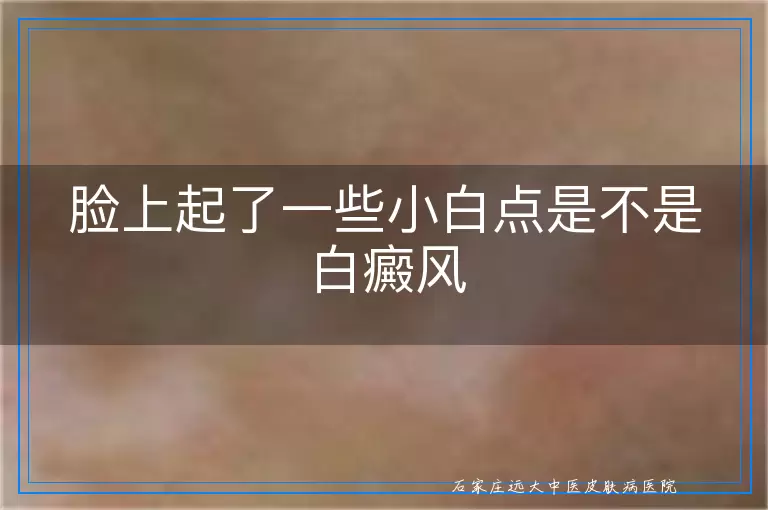脸上起了一些小白点是不是白癜风