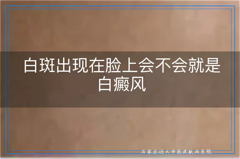 白斑出现在脸上会不会就是白癜风