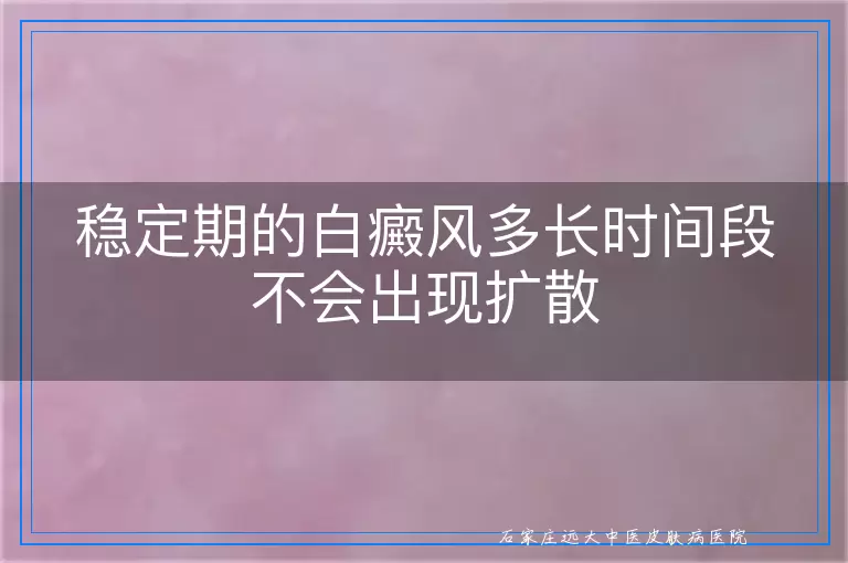 稳定期的白癜风多长时间段不会出现扩散