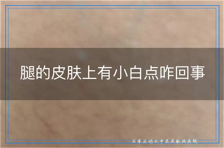 腿的皮肤上有小白点咋回事
