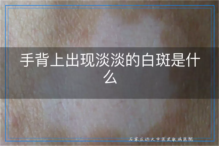 手背上出现淡淡的白斑是什么