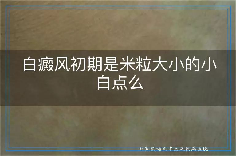 白癜风初期是米粒大小的小白点么