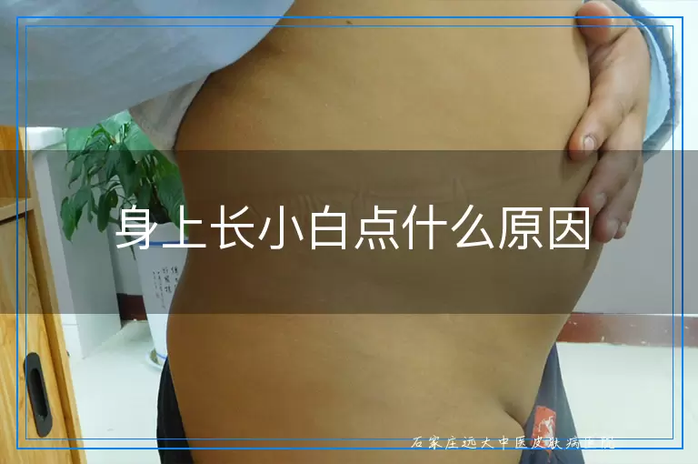 身上长小白点什么原因