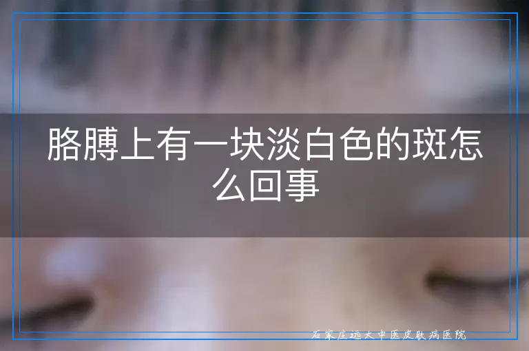 胳膊上有一块淡白色的斑怎么回事
