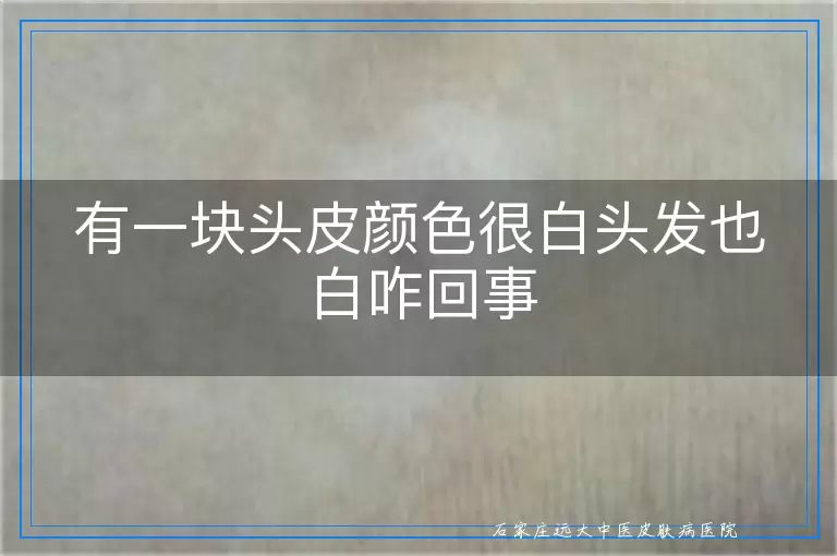 有一块头皮颜色很白头发也白咋回事