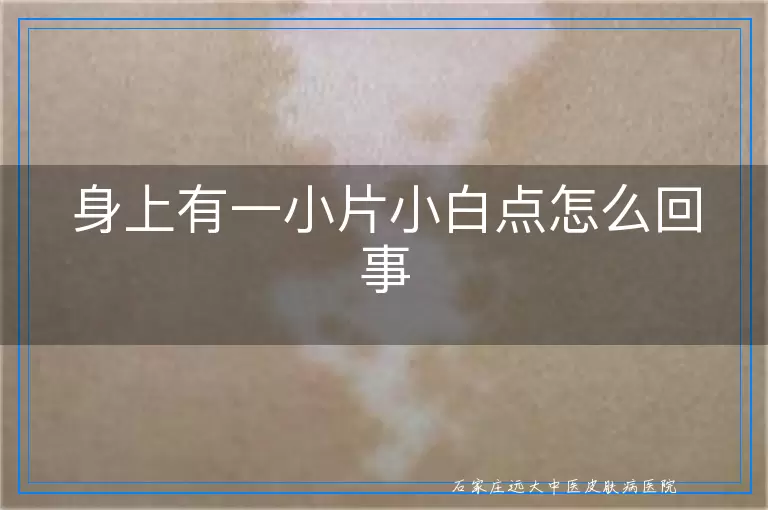 身上有一小片小白点怎么回事