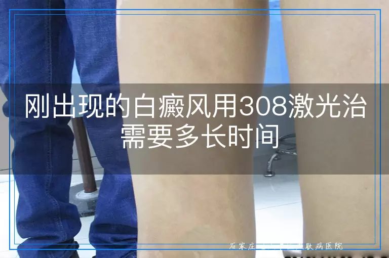 刚出现的白癜风用308激光治 需要多长时间