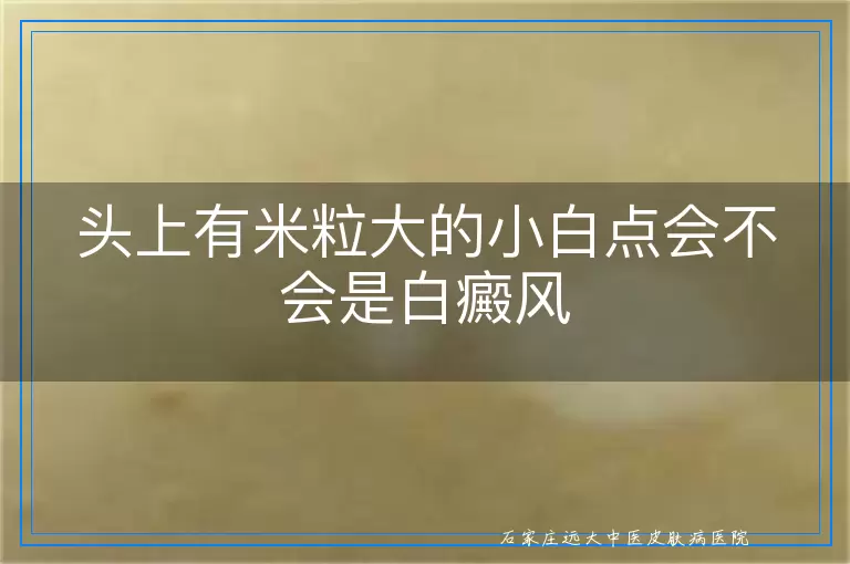 头上有米粒大的小白点会不会是白癜风