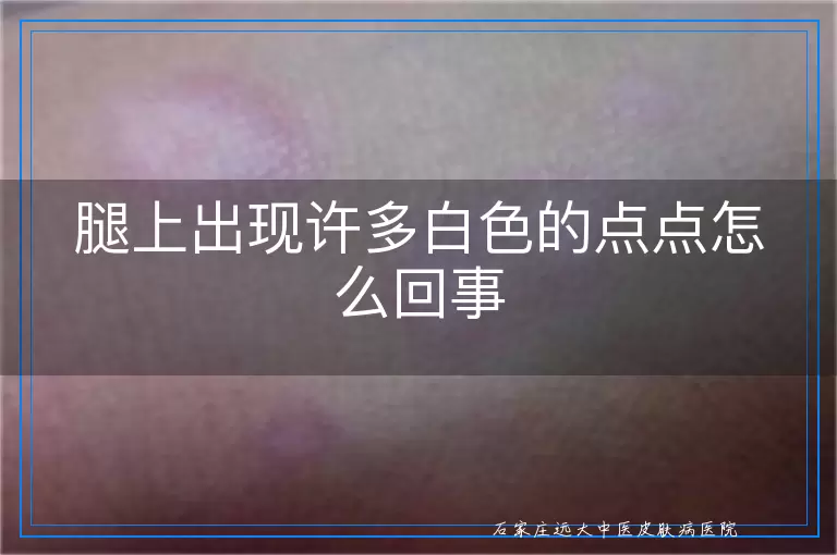 腿上出现许多白色的点点怎么回事