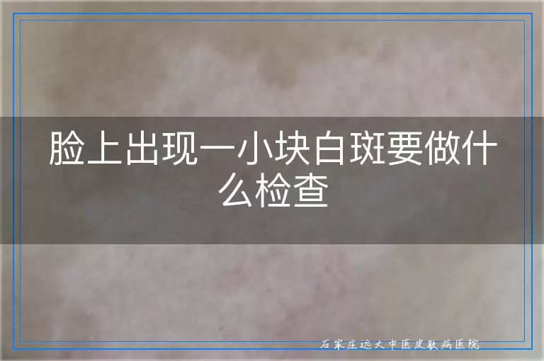 脸上出现一小块白斑要做什么检查
