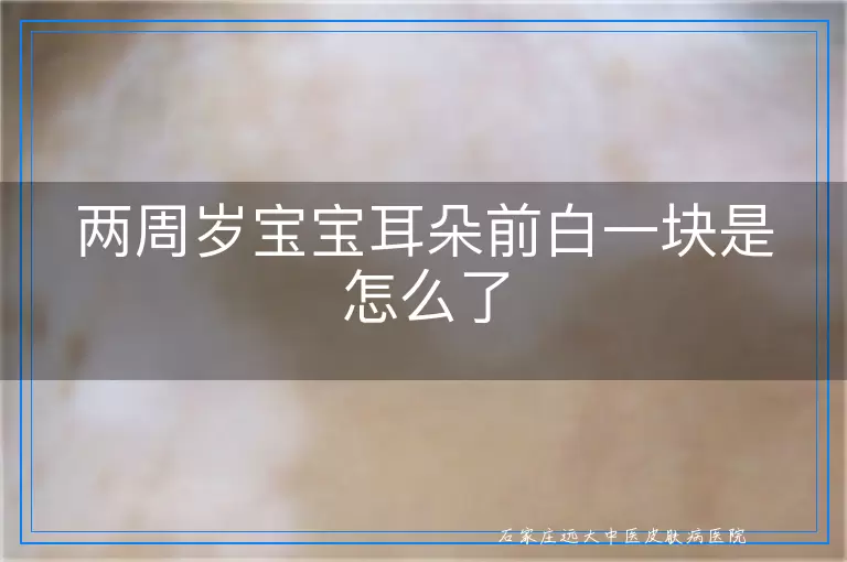 两周岁宝宝耳朵前白一块是怎么了
