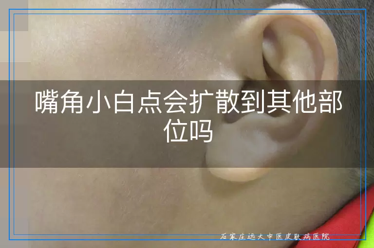 嘴角小白点会扩散到其他部位吗