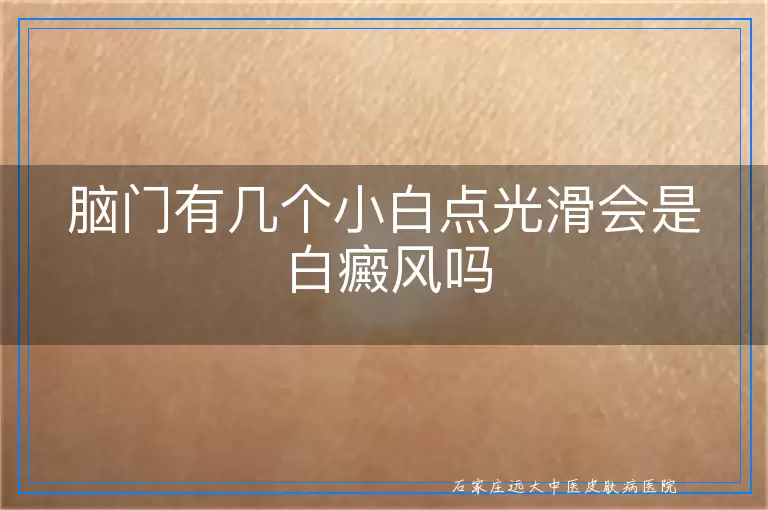 脑门有几个小白点光滑会是白癜风吗
