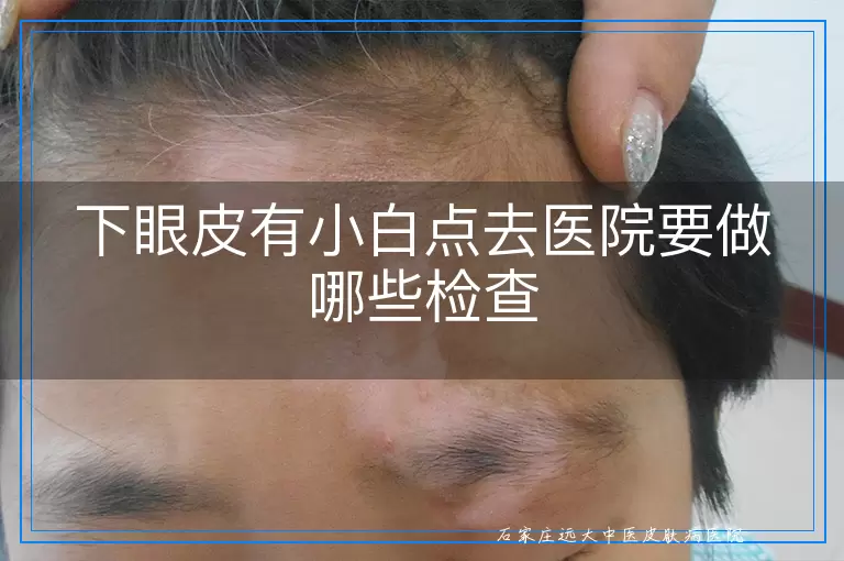 下眼皮有小白点去医院要做哪些检查