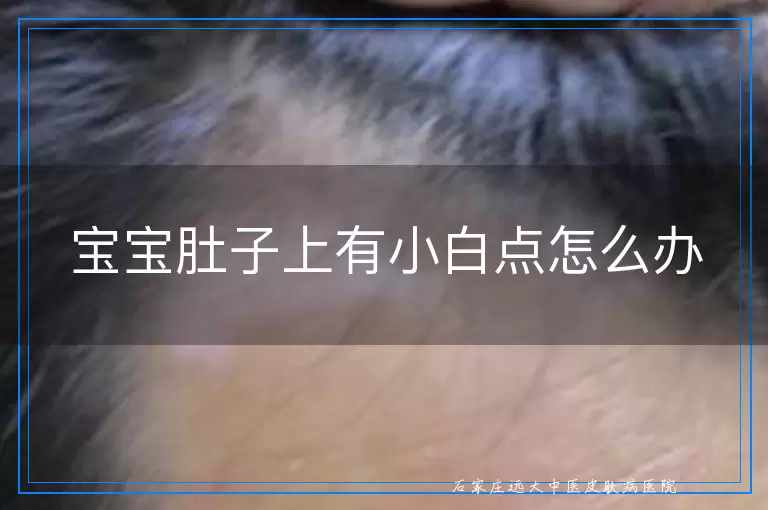 宝宝肚子上有小白点怎么办