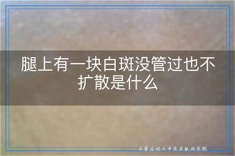 腿上有一块白斑没管过也不扩散是什么