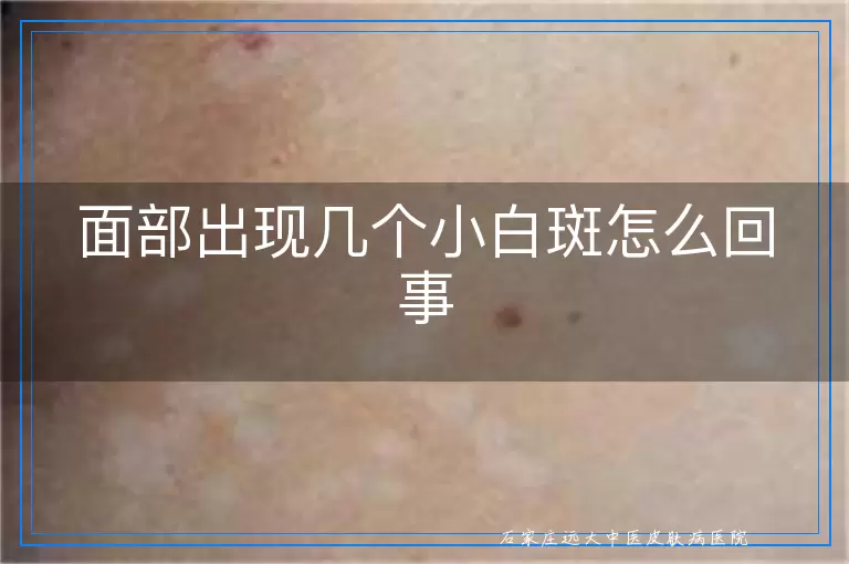 面部出现几个小白斑怎么回事