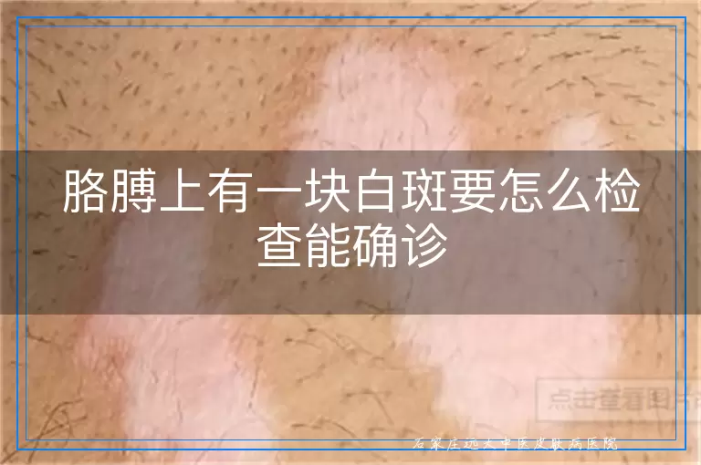 胳膊上有一块白斑要怎么检查能确诊