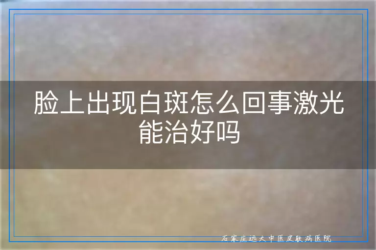 脸上出现白斑怎么回事激光能治好吗