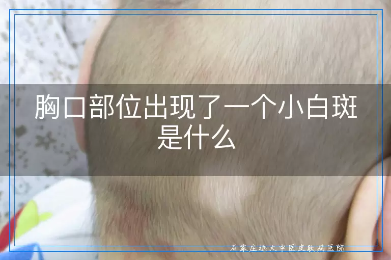 胸口部位出现了一个小白斑是什么