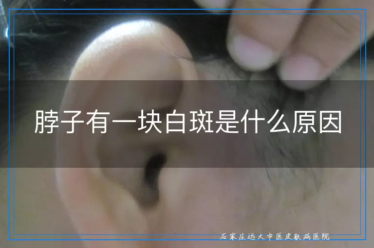 脖子有一块白斑是什么原因