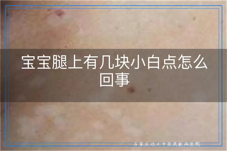 宝宝腿上有几块小白点怎么回事