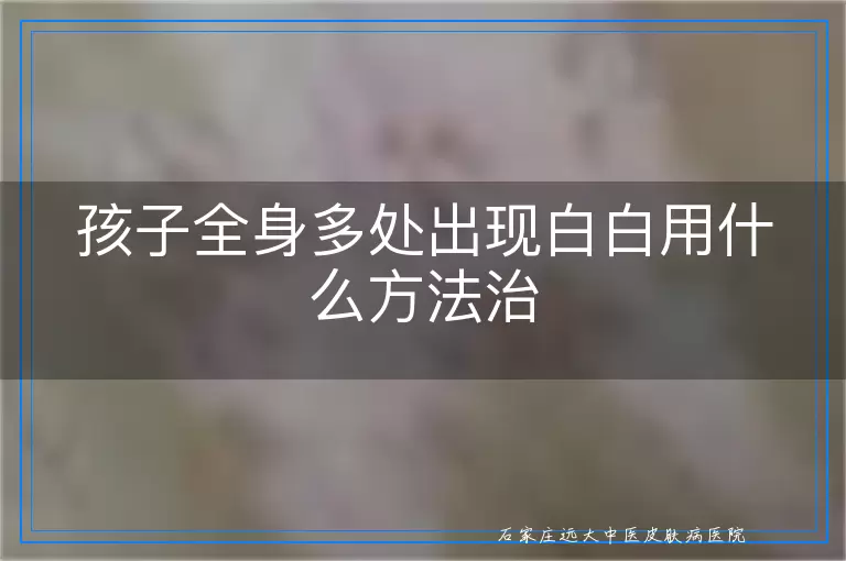 孩子全身多处出现白白用什么方法治