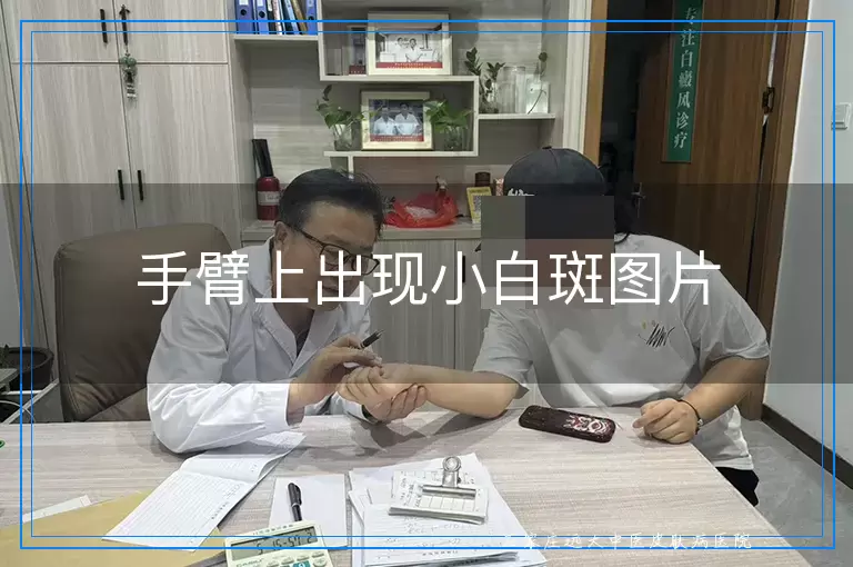 手臂上出现小白斑图片