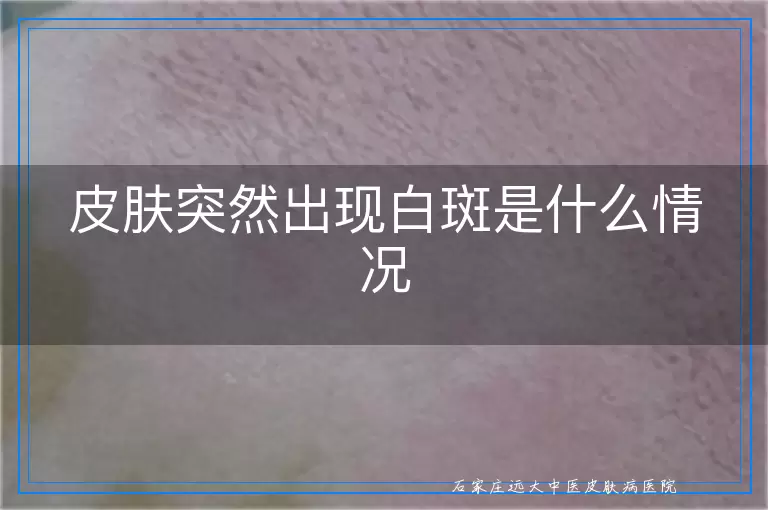 皮肤突然出现白斑是什么情况