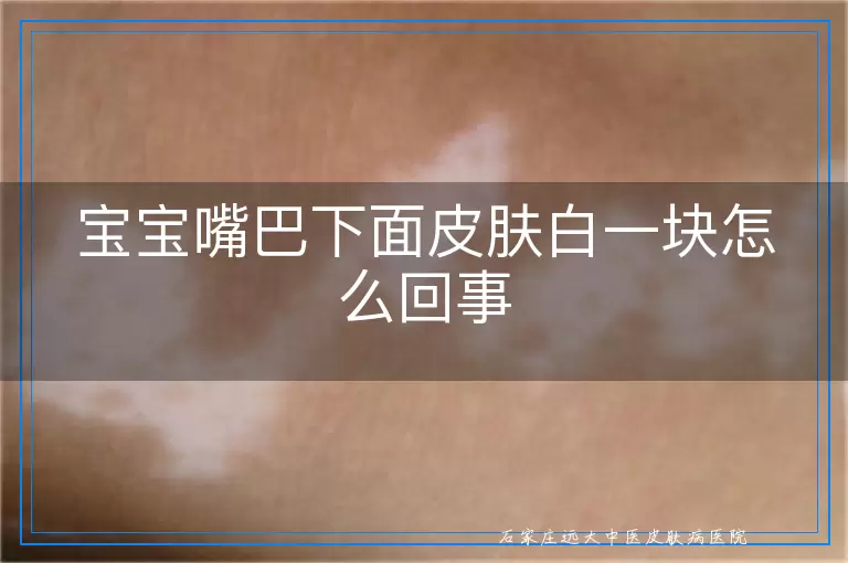 宝宝嘴巴下面皮肤白一块怎么回事