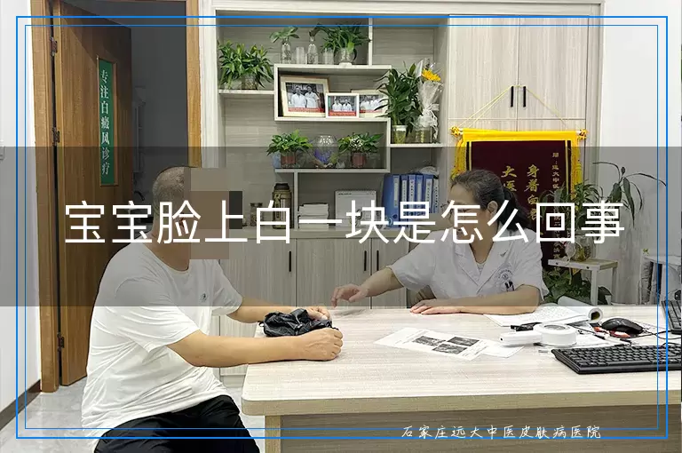 宝宝脸上白一块是怎么回事