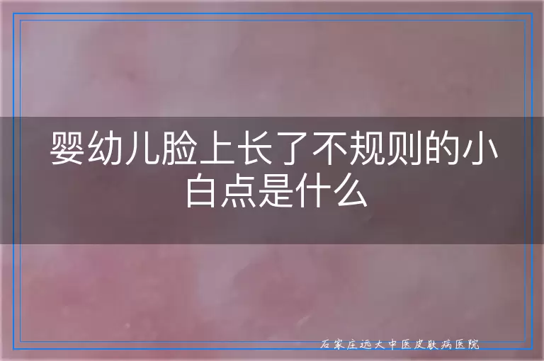 婴幼儿脸上长了不规则的小白点是什么