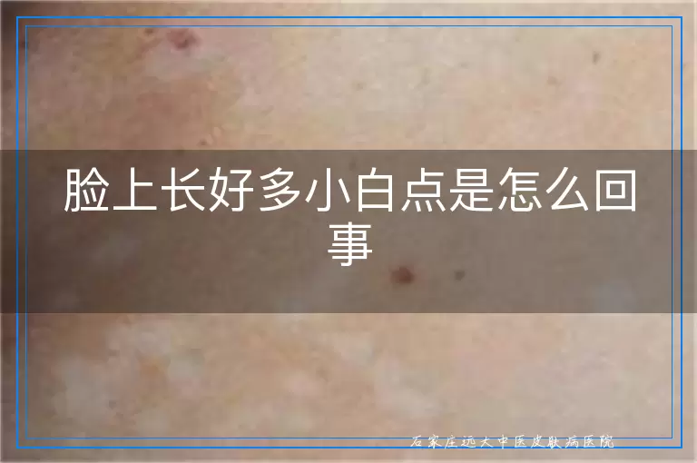 脸上长好多小白点是怎么回事