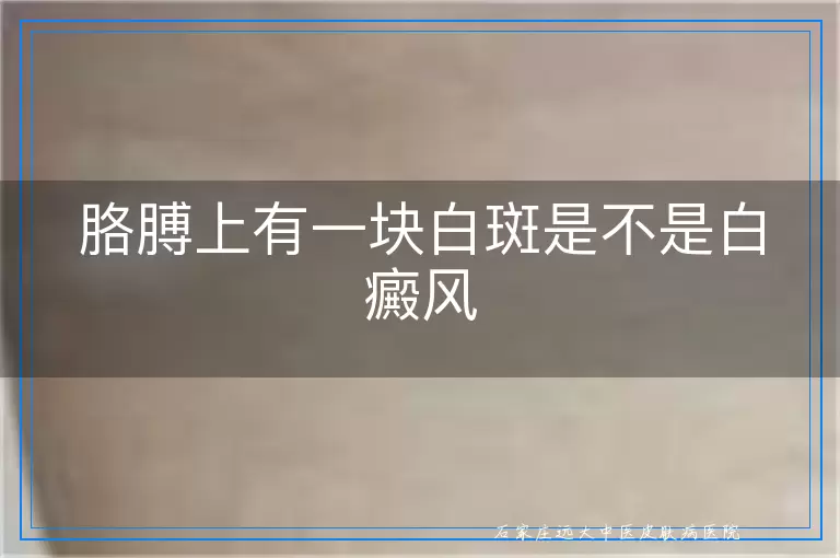 胳膊上有一块白斑是不是白癜风