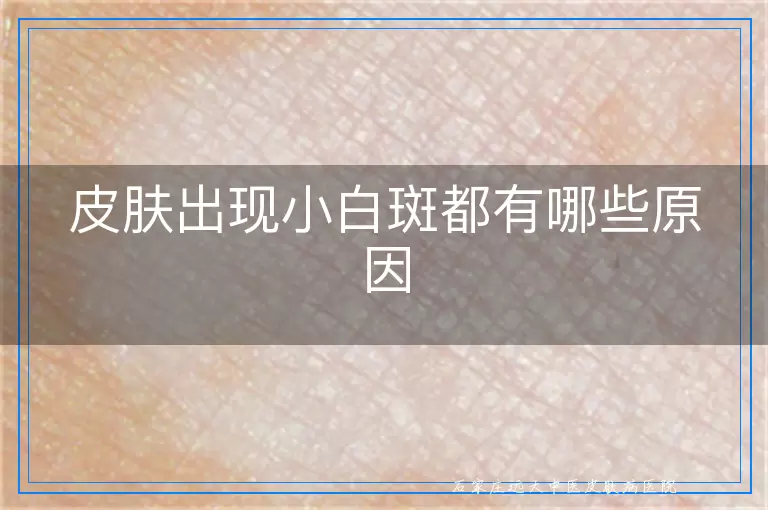 皮肤出现小白斑都有哪些原因