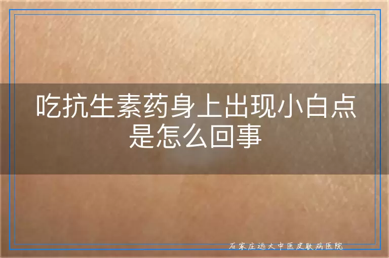 吃抗生素药身上出现小白点是怎么回事