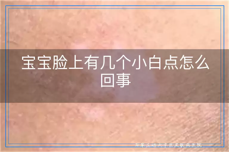宝宝脸上有几个小白点怎么回事