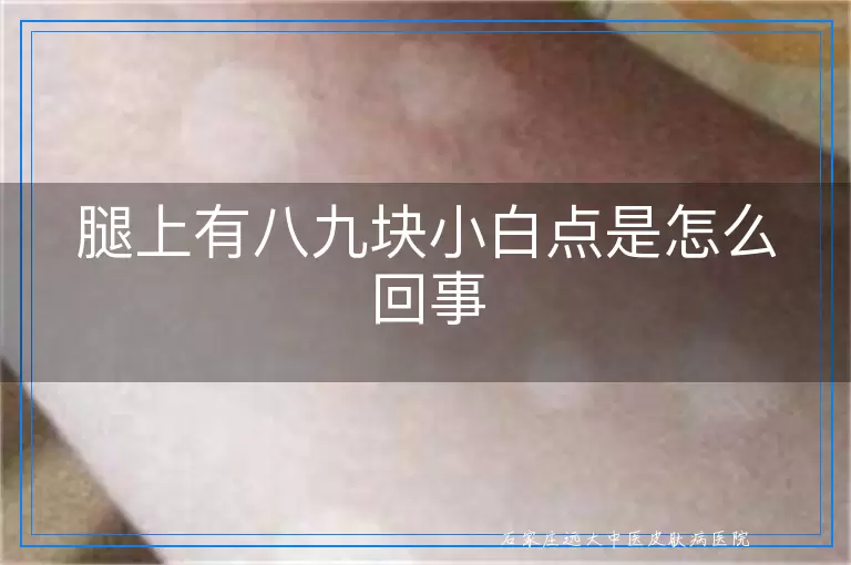 腿上有八九块小白点是怎么回事
