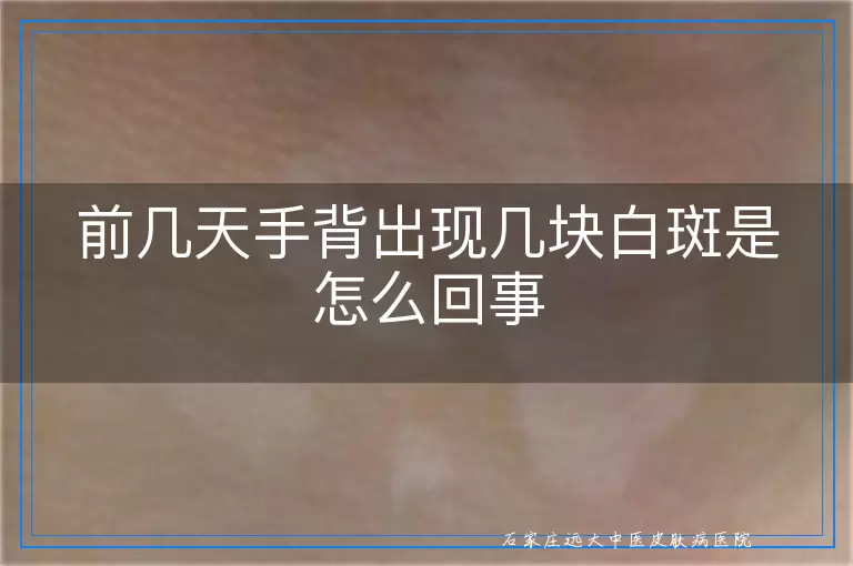 前几天手背出现几块白斑是怎么回事