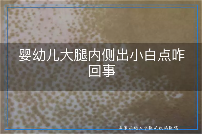 婴幼儿大腿内侧出小白点咋回事