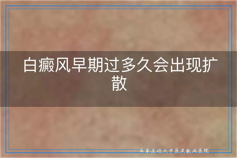 白癜风早期过多久会出现扩散