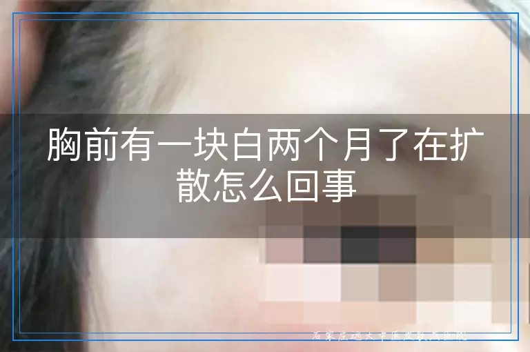 胸前有一块白两个月了在扩散怎么回事