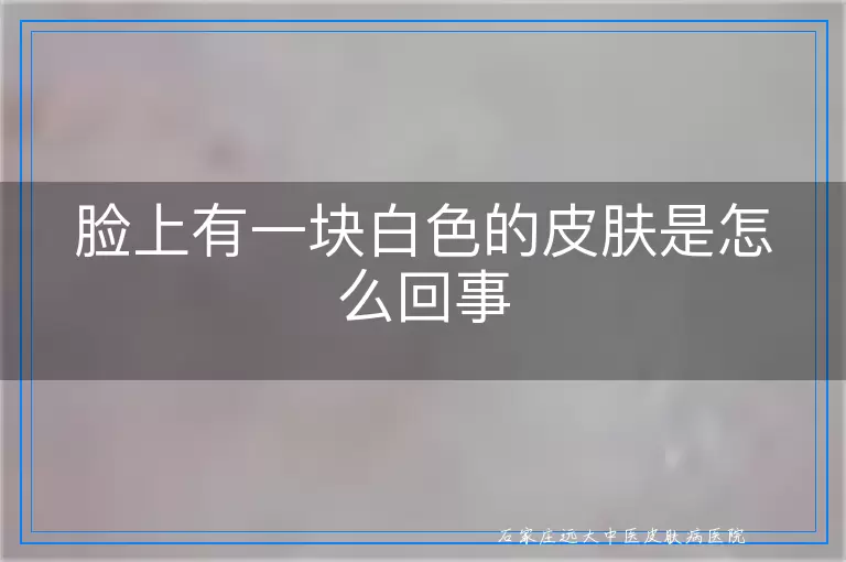 脸上有一块白色的皮肤是怎么回事