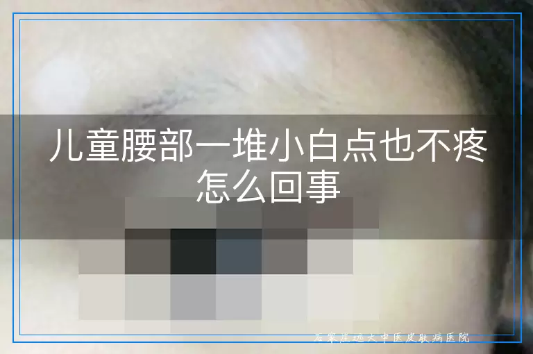 儿童腰部一堆小白点也不疼怎么回事