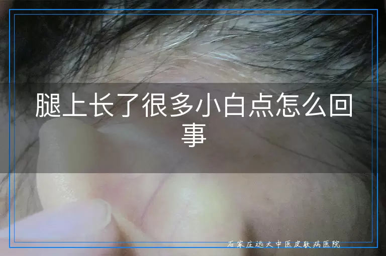 腿上长了很多小白点怎么回事