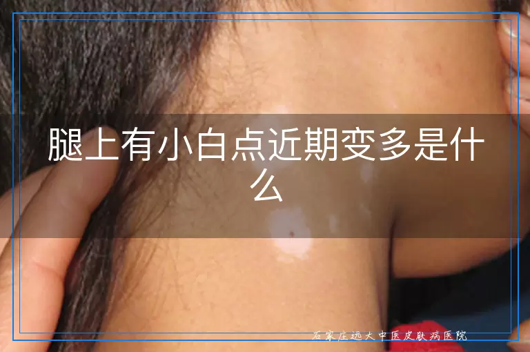 腿上有小白点近期变多是什么