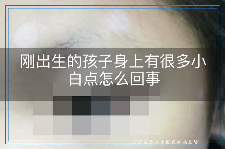 刚出生的孩子身上有很多小白点怎么回事