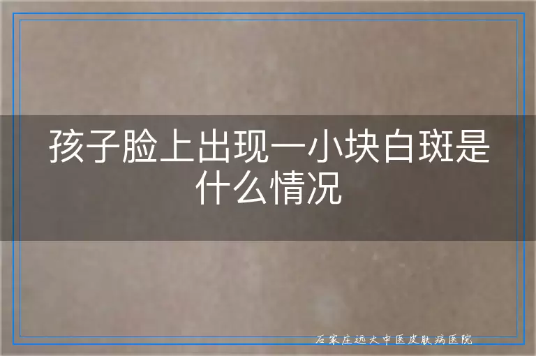 孩子脸上出现一小块白斑是什么情况