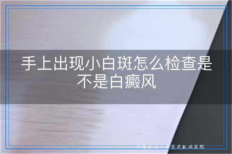 手上出现小白斑怎么检查是不是白癜风