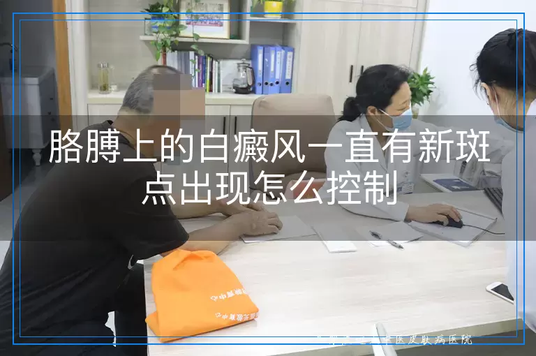 胳膊上的白癜风一直有新斑点出现怎么控制